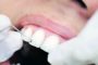 Zobobol ima lahko številne vzroke