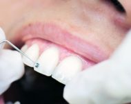 zobozdravnik-1